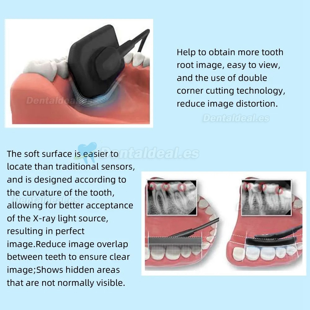 Sensor de Rayos X de Imagen Digital Dental RVG Sistema de Imágenes Intraorales Dentales